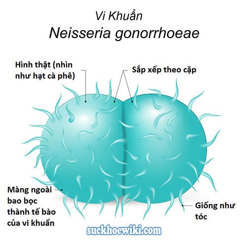Hình ảnh Vi khuẩn Neisseria Gonorrhoeae