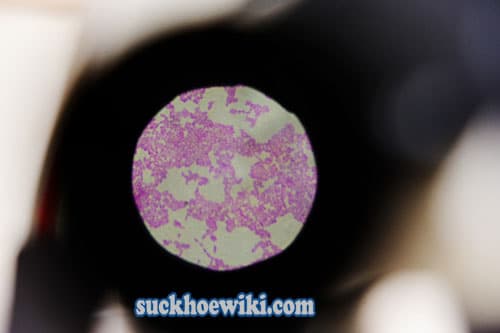 Một phần tử bệnh lậu qua kính hiển vi