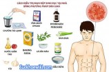 13 Cách điều trị mụn rộp sinh dục tại nhà [Hỗ trợ khắc phục]