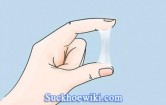 Khí hư màu trắng đục như bã đậu nguyên nhân, cách khắc phục hiệu quả nhất
