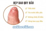 Hẹp bao quy đầu là gì? Nguyên nhân, triệu chứng và cách chữa bệnh