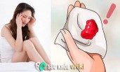 Kinh nguyệt ra từng mảng có sao không? dấu hiệu của bệnh gì?