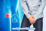 Tiểu buốt, tiểu rắt sau khi quan hệ phải làm sao?