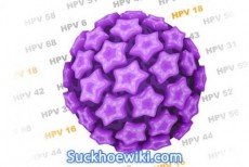 Virus HPV là gì? Xét nghiệm HPV ở đâu và bao nhiêu tiền?