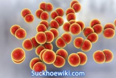 Vi khuẩn lậu Neisseria Gonorrhoeae: Dấu hiệu và cách điều trị