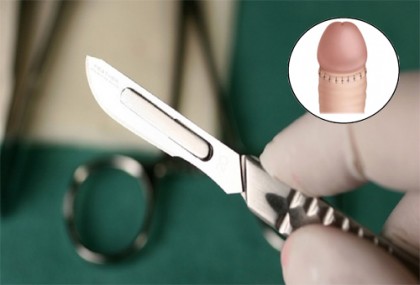 5 địa chỉ cắt bao quy đầu ở đâu tốt uy tín tại Hà Nội